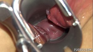 pornhot with a speculum in her vagina